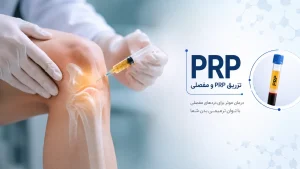 تزریق PRP و مفصلی در شهریار
