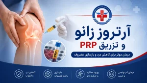 آرتروز زانو و تزریق PRP در درمانگاه کیمیا