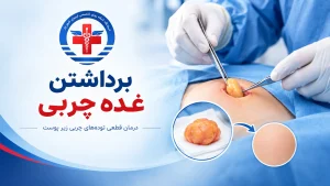 برداشتن غده چربی در شهریار درمانگاه کیمیا